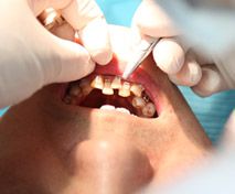 天津東麗華都人流醫院